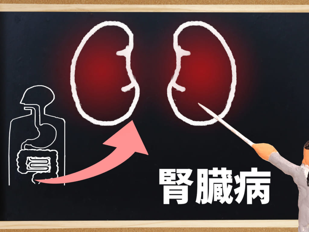 ckd